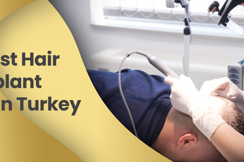 The Best Hair transplant Clinic in Turkey