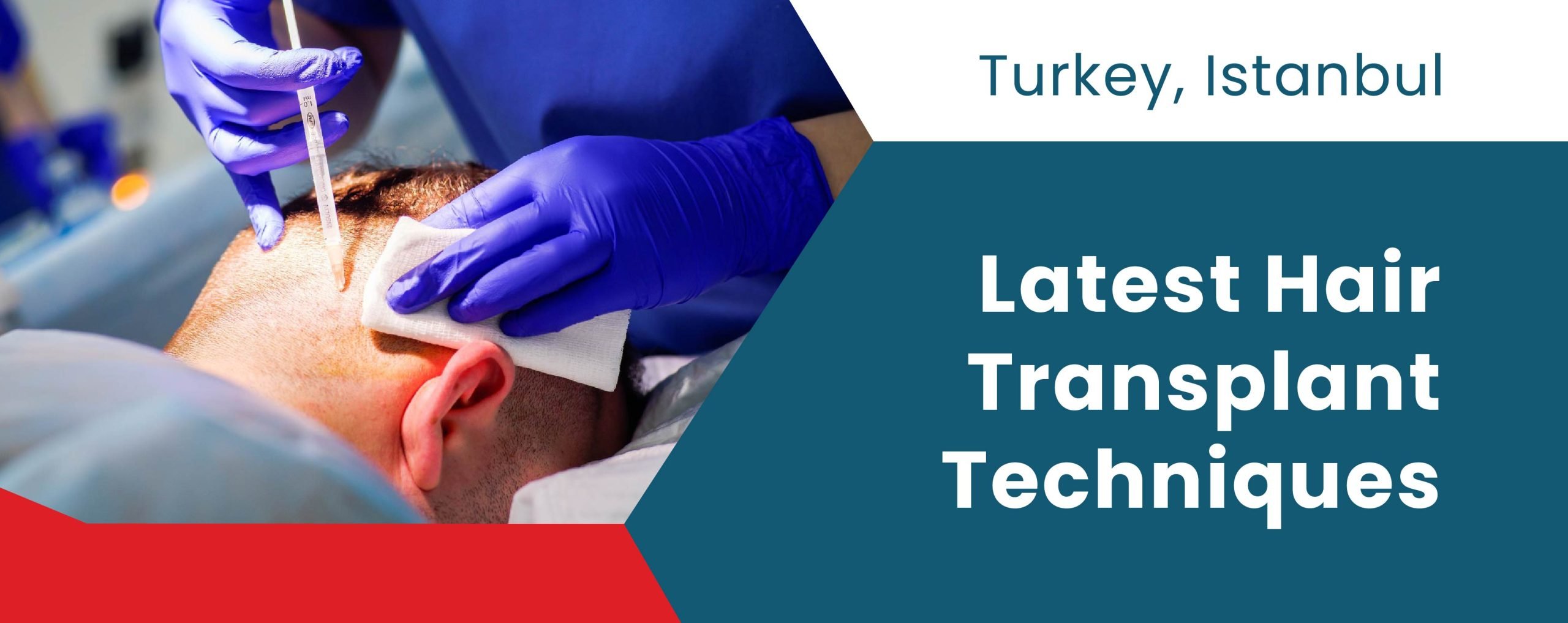 Latest Hair Transplant Techniques in Turkey | ClinMedica