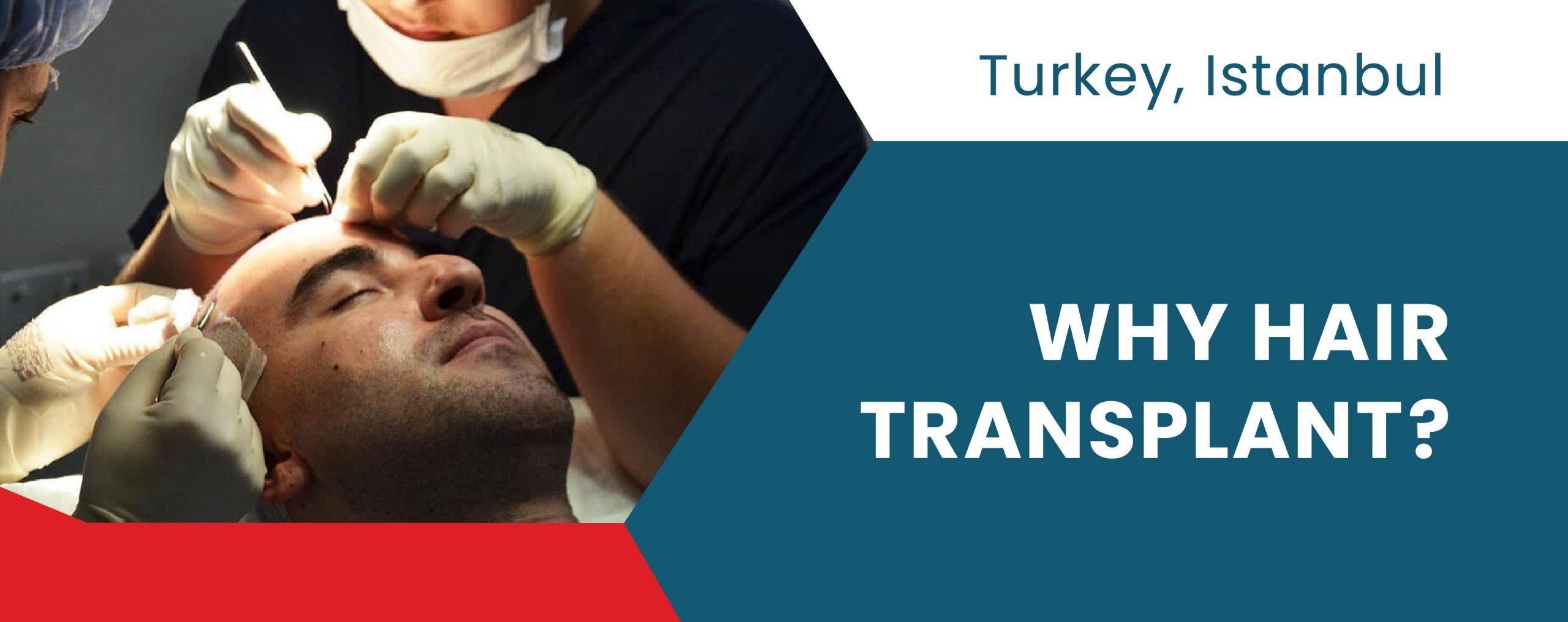 Why Hair Transplant in Turkey