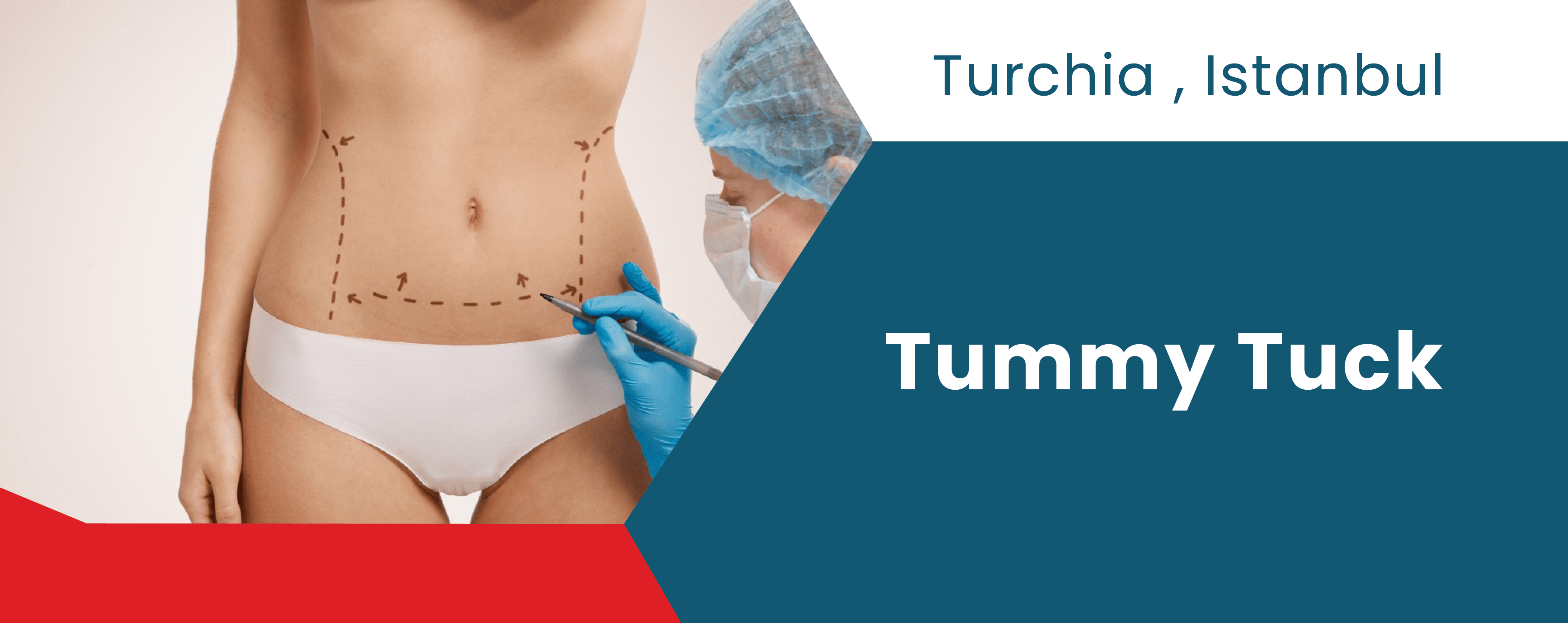 Plastische Chirurgie in der Türkei | Bauchdeckenstraffung und Fettabsaugung | Patientenbewertungen | ClinMedica