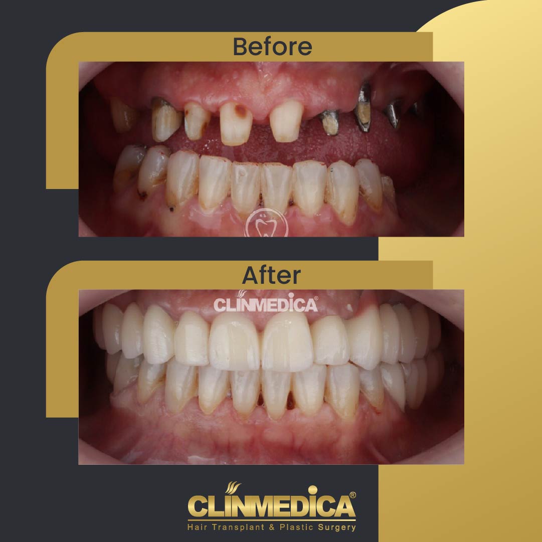 5Dentist before and after-01