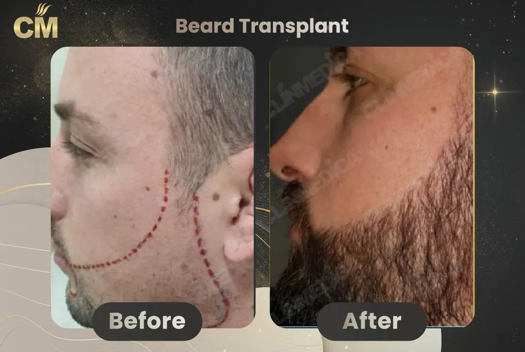 a man's face before and after surgery