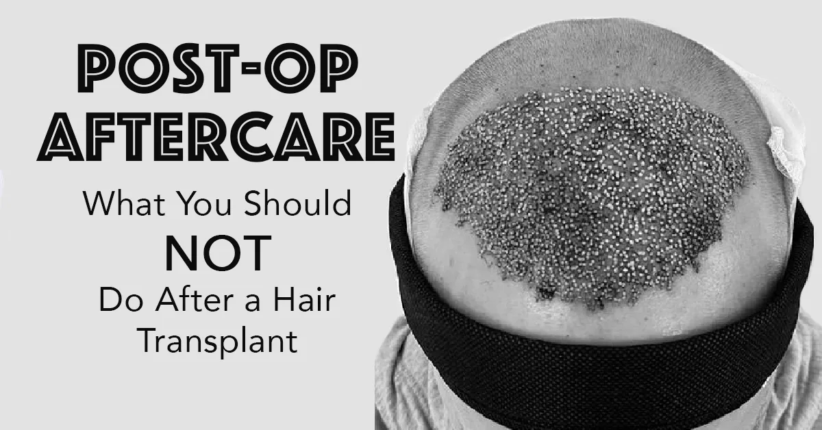 a person with a hair loss problem