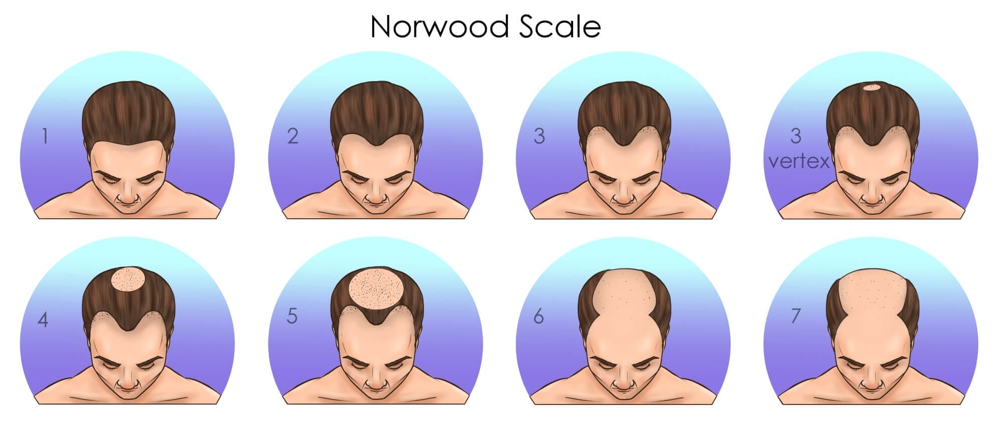 a man's head with balding