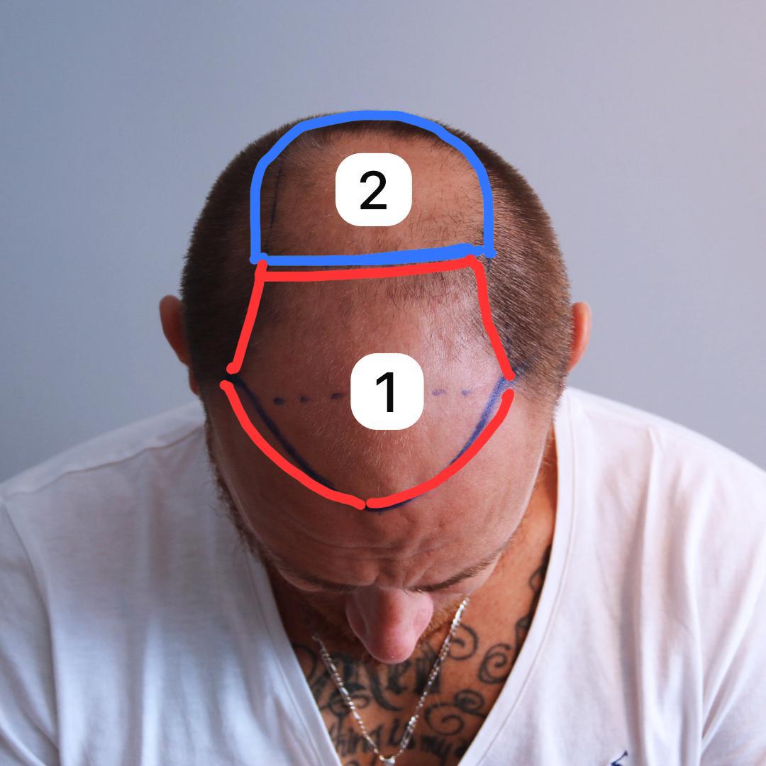 a man with a bald head